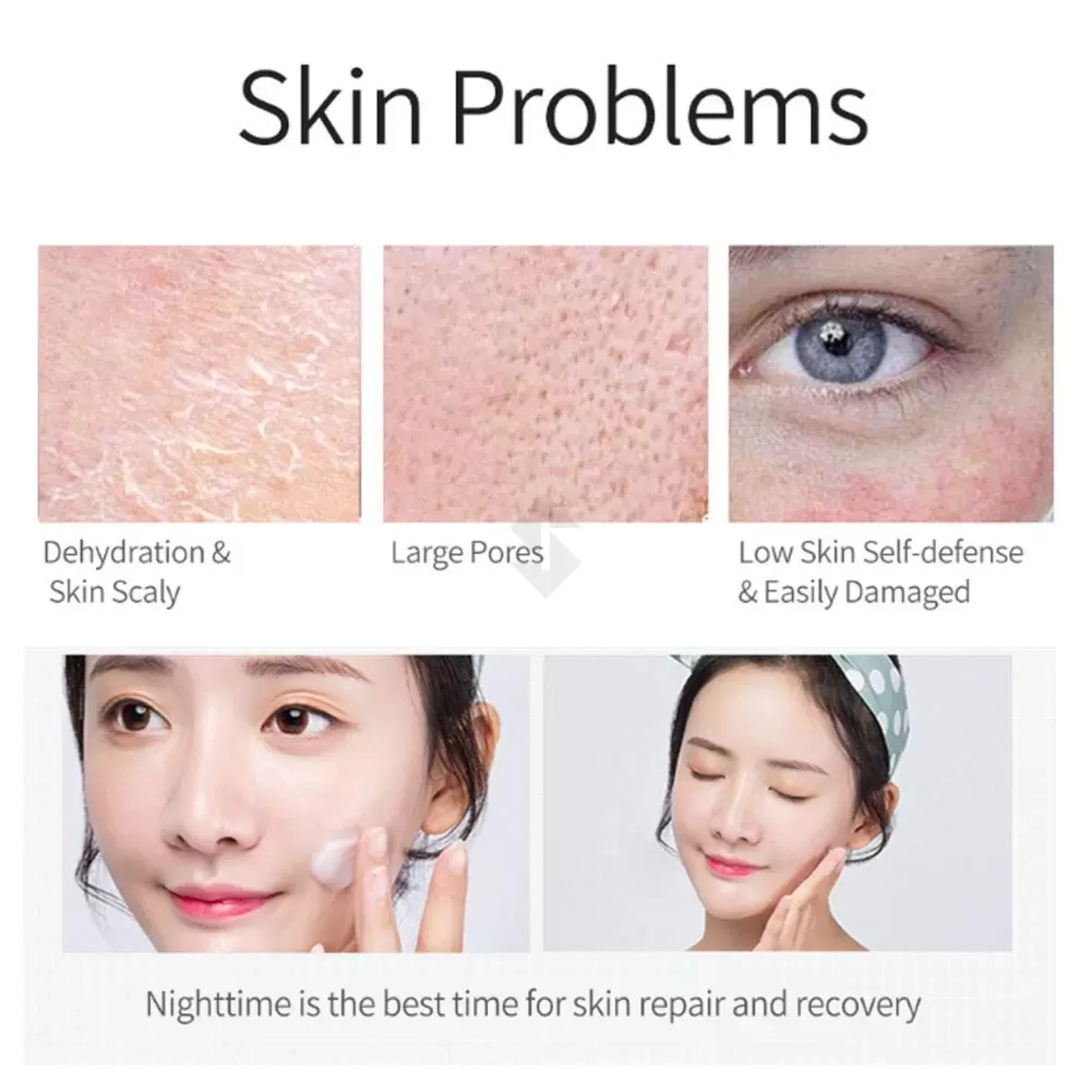 Salicyclic acid Mask 300m4.webp